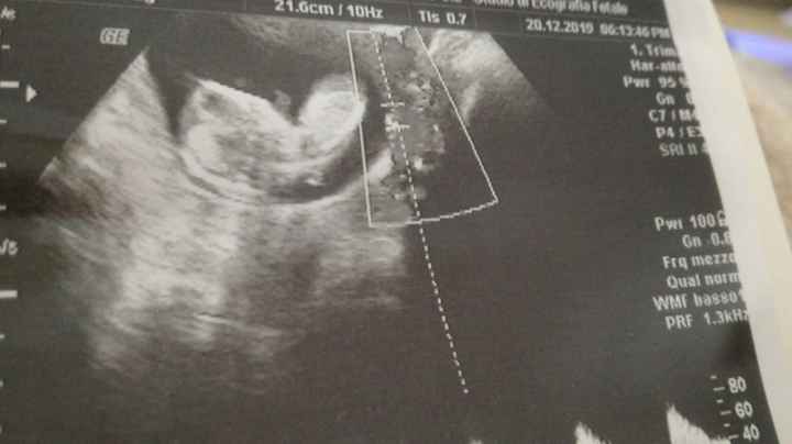 Maschietto o femminuccia in base alla nub theory? - 1