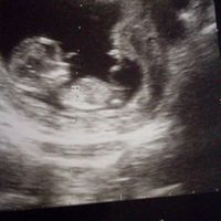 Maschietto o femminuccia in base alla nub theory? - 1