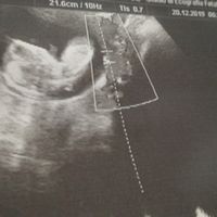 Maschietto o femminuccia in base alla nub theory? - 1