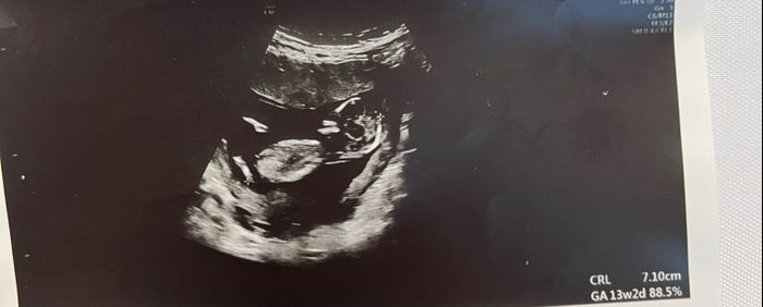 Future mamme marzo 2023 1