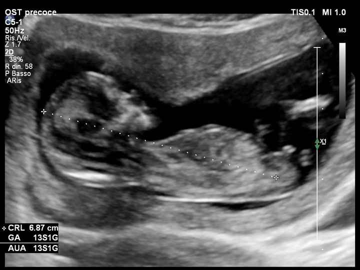 Future mamme Giugno 2021 💛🐠🍀🌻 - 1