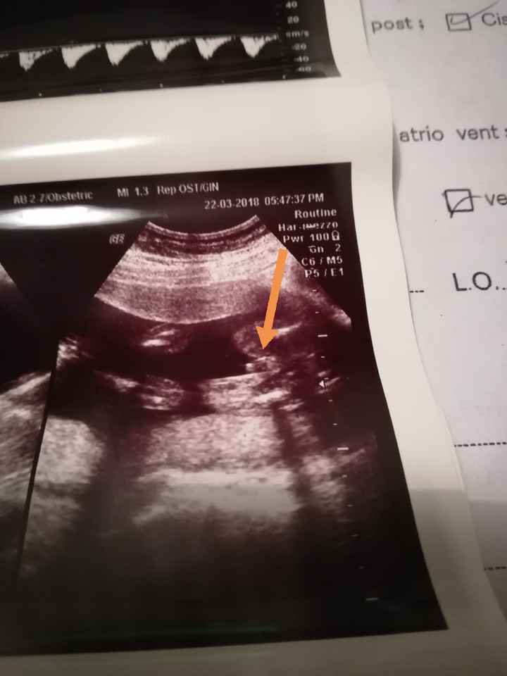 Maschietto birichino 😋 - 1