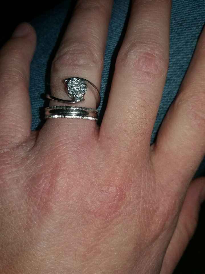 Vi piace il mio anello? - 1