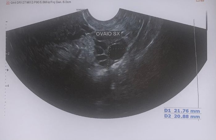 14pm test ovulazione negativo 2