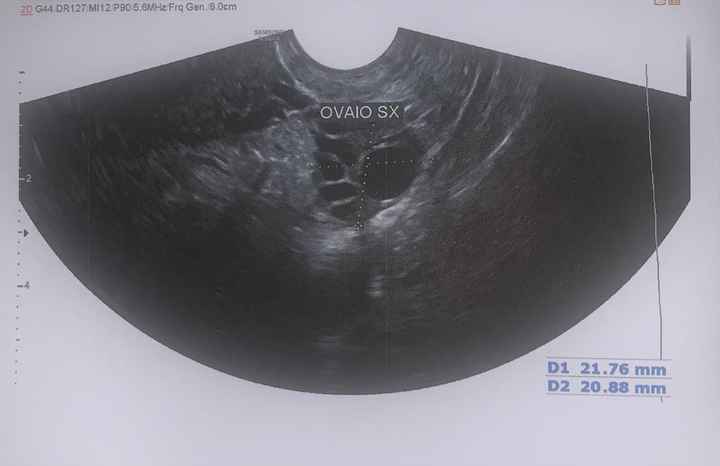 11 giorno ciclo e test ovulazione - 1