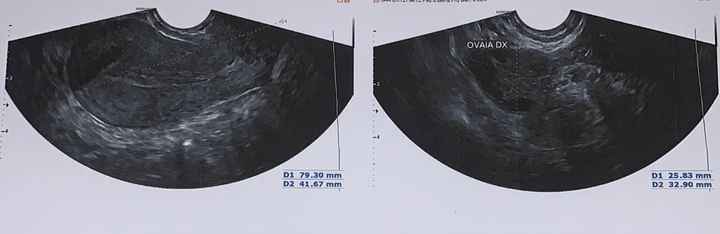 Temperatura basale per ricerca cicogna 🤞🏻 - 1