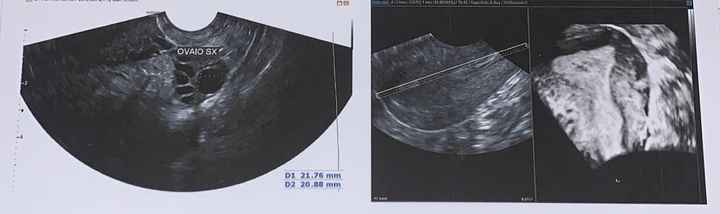 Temperatura basale per ricerca cicogna 🤞🏻 - 2