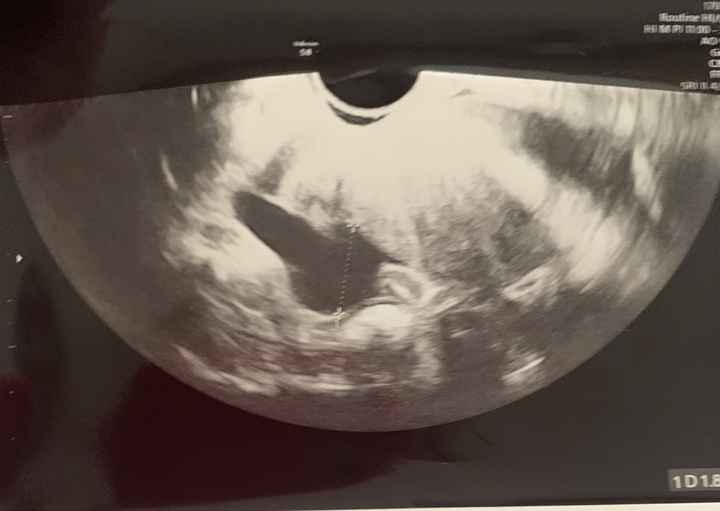 Temperatura basale per ricerca cicogna 🤞🏻 - 1