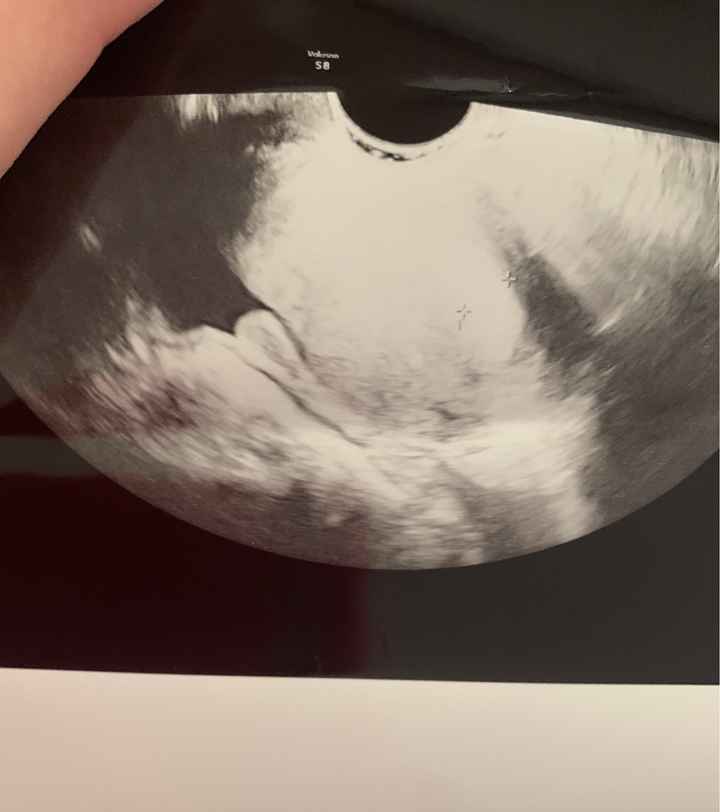 Temperatura basale per ricerca cicogna 🤞🏻 - 2