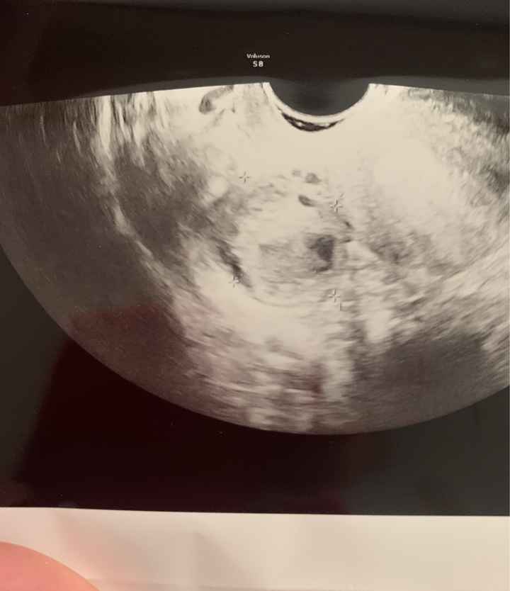 Temperatura basale per ricerca cicogna 🤞🏻 - 3