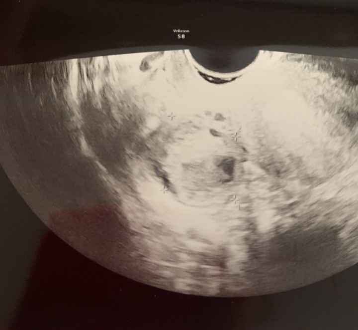 Temperatura basale per ricerca cicogna 🤞🏻 - 1