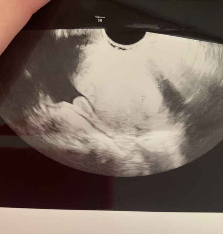 Temperatura basale per ricerca cicogna 🤞🏻 - 3