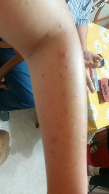 Ricrescita ceretta - 1