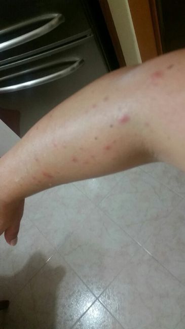 Ricrescita ceretta - 2