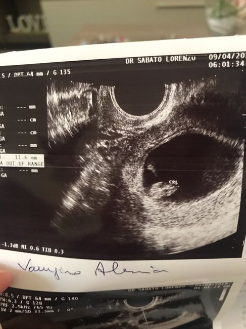 Future mamme di novembre - 1