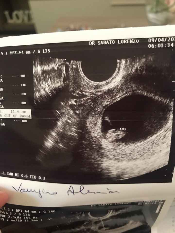 Future mamme di novembre - 1