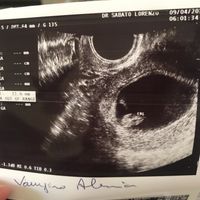 Future mamme di novembre - 1