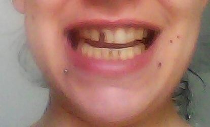 Ragazze aiuto qualcuno che sia dentista? - 1