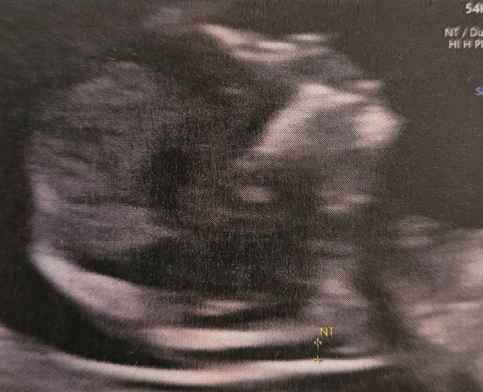 Future mamme febbraio/marzo/aprile 2026 🌸🌼🌿🌾 - 1