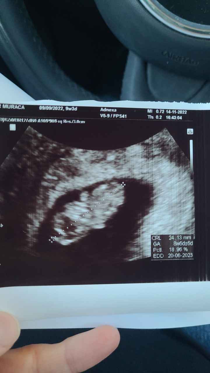 Future mamme Giugno 2023☀️♥️ - 1