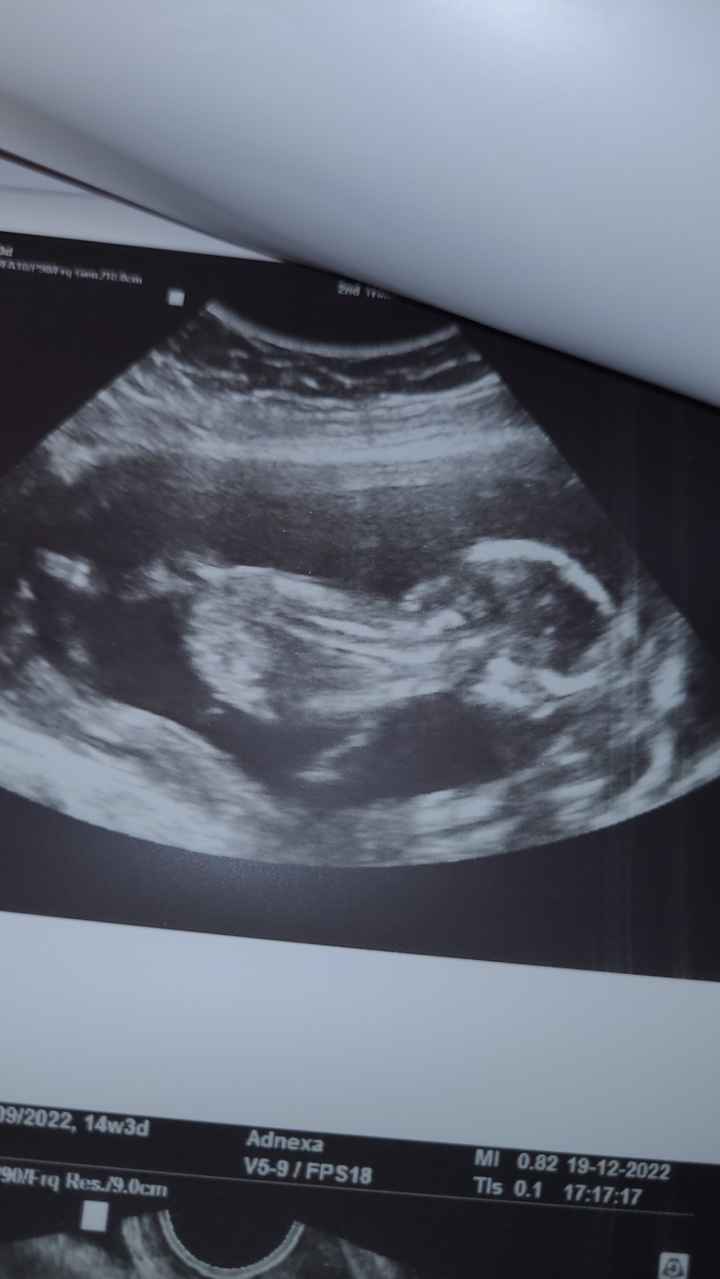 Future mamme Giugno 2023☀️♥️ - 1