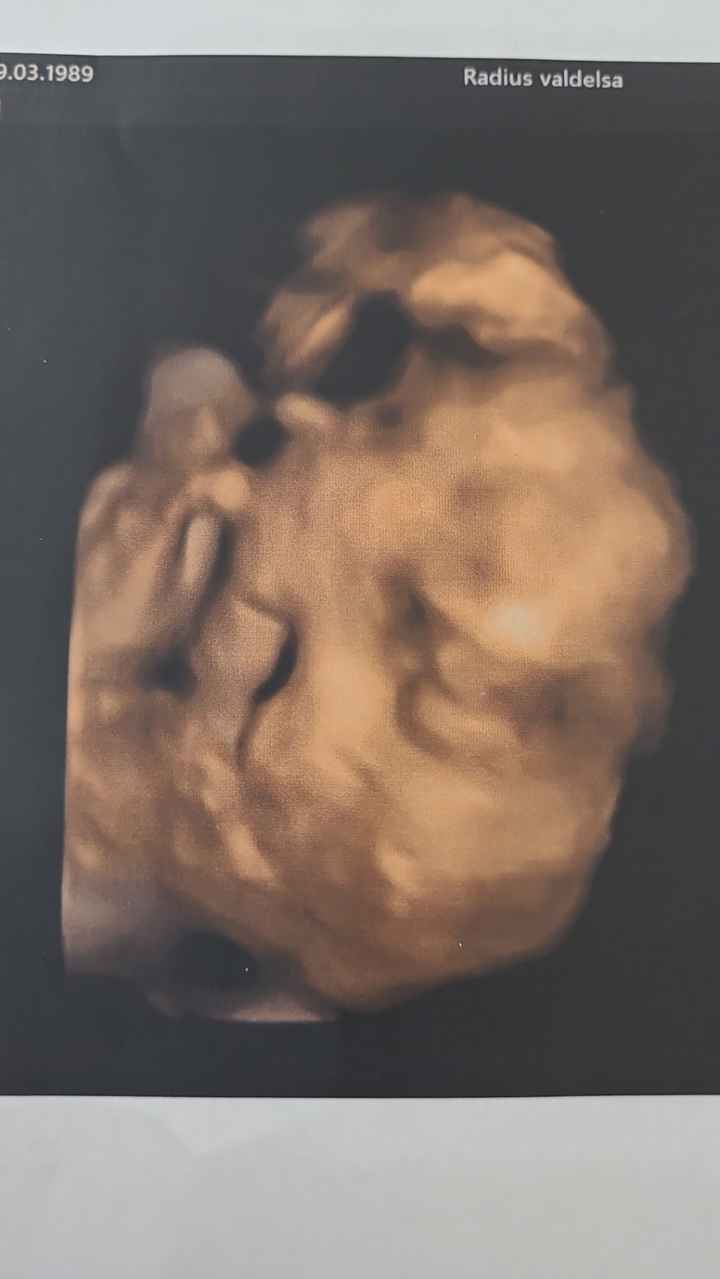 Future mamme Giugno 2023☀️♥️ - 2