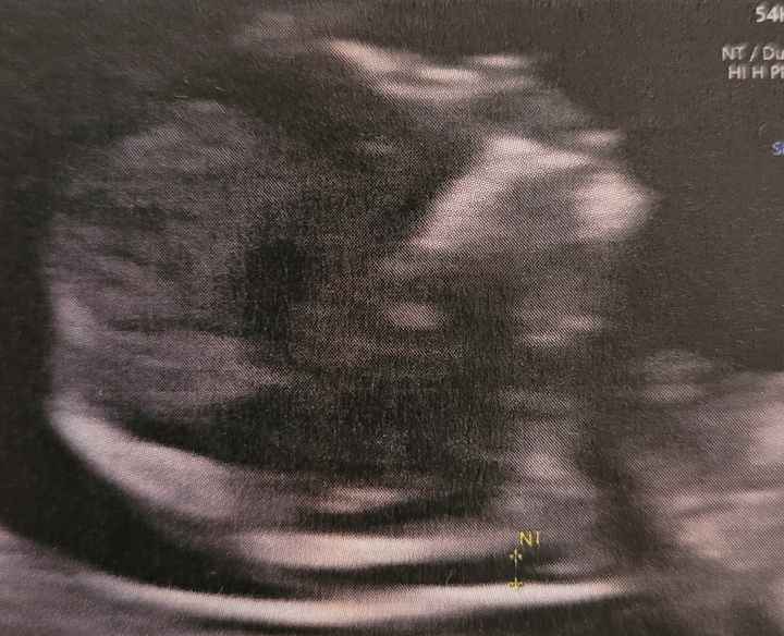 Future mamme febbraio/marzo/aprile 2026 🌸🌼🌿🌾 - 1