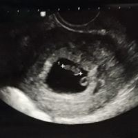 Maschio o Femmina? - 1