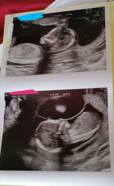 Mamme di Agosto 2020😍🤞😍 - 1