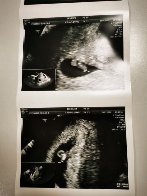 Dubbio camera gestazionale - 1