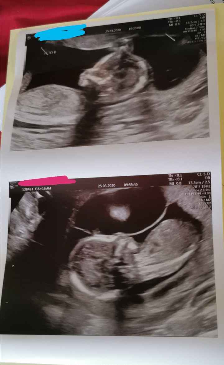 Mamme di Agosto 2020😍🤞😍 2