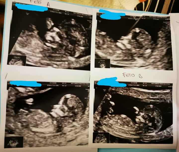 Mamme di Agosto 2020😍🤞😍 3