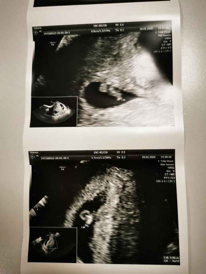 Dubbio camera gestazionale - 1