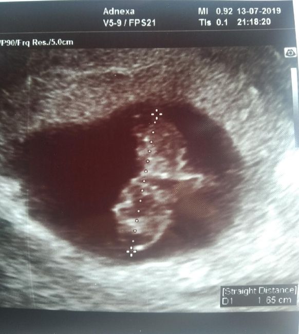 secondo voi maschio o femmina? 1