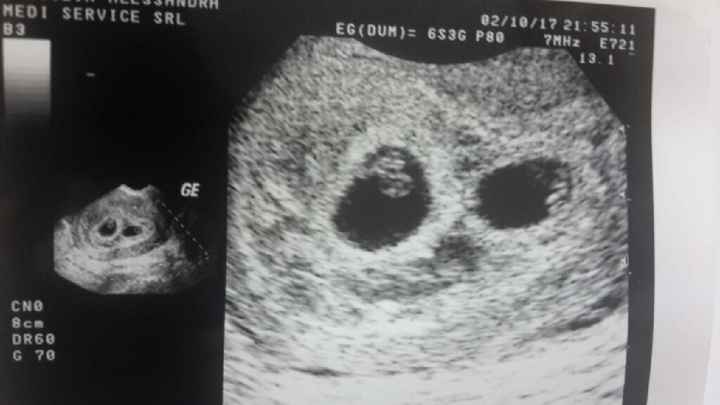  a 6+3...semini pulsanti! - 1