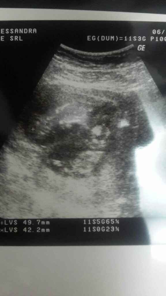  Future mamme maggio-giugno/2018 - 1