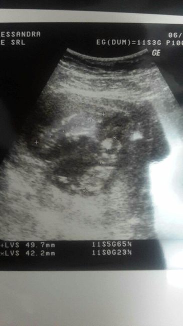 Future mamme maggio-giugno/2018 1