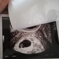 Metodo Ramzi! Chi ci sa azzeccare? - 1