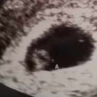 Metodo Ramzi! Chi ci sa azzeccare? - 1