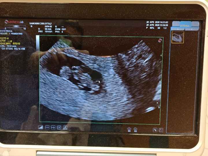 Metodo Ramzi! Chi ci sa azzeccare? - 1