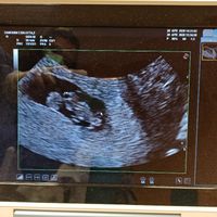 Metodo Ramzi! Chi ci sa azzeccare? - 1