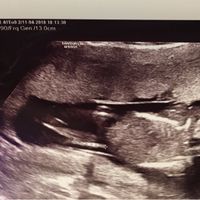 Future mamme di ottobre, in quante siamo, come procede? - 1