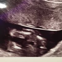 Future mamme di ottobre, in quante siamo, come procede? - 2