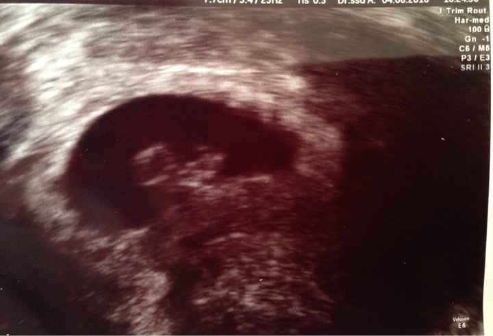 Mamme gennaio 2017 - 1