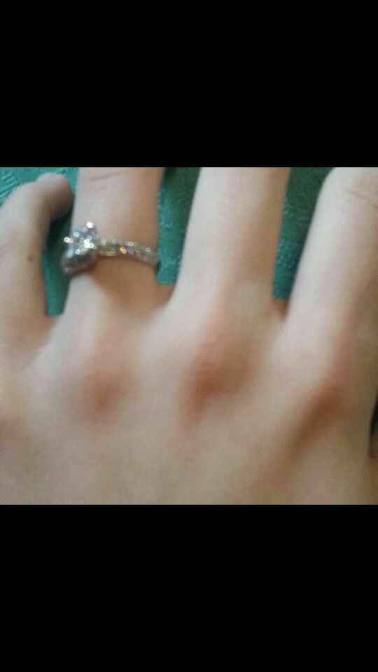 Anello: a me proprio non piace 👎 - 2