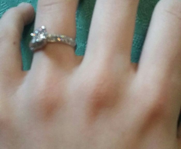  Anello particolare - 2