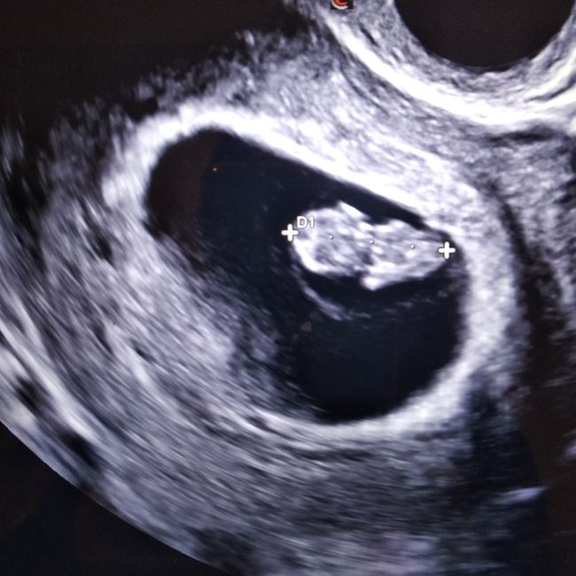 Future Mamme Ottobre 2021 - 1