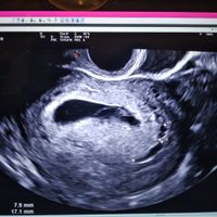 Future Mamme Ottobre 2021 - 2