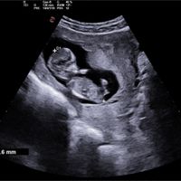 Future Mamme Ottobre 2021 - 1