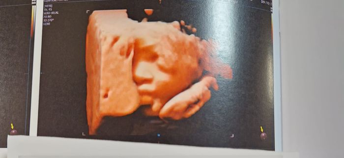 Future mamme Maggio 2023 - 1